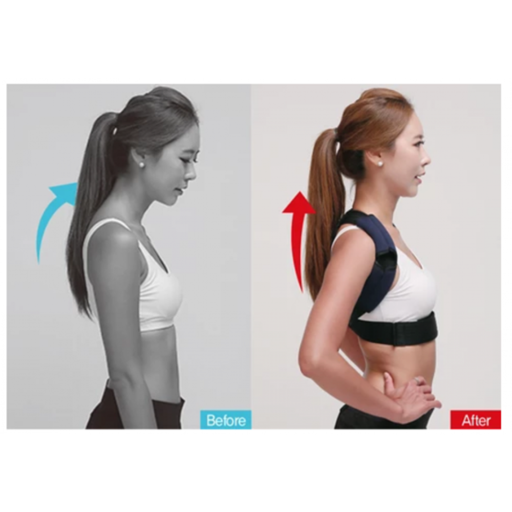 Before and 2024 after posture corrector